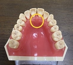正しい舌の位置、知っていますか？