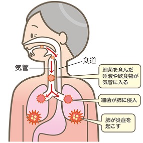 摂食･嚥下について
