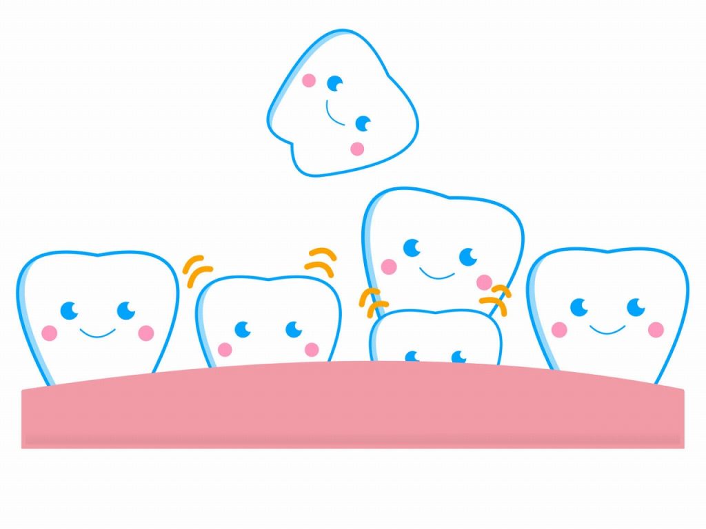 歯がグラグラしてきました！