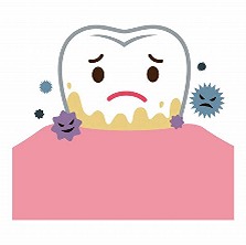 歯周病ってどんな病気？メンテナンスが重要です！