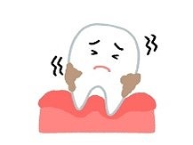 歯周病検査はなぜ必要なのか