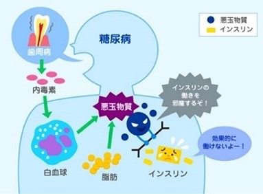 歯周病と糖尿病の深〜い関係！