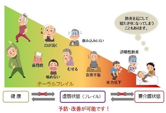 それってオーラルフレイルかも⁉