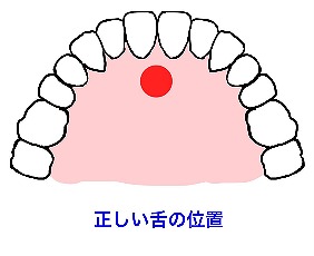 お子様の舌の位置、とても大切です！！