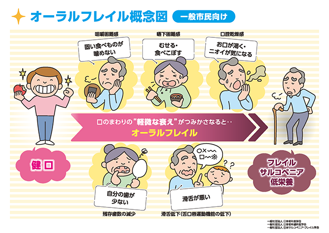 オーラルフレイルかも？