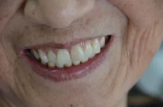 症例紹介